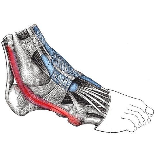 Тендинит малоберцовой мышцы